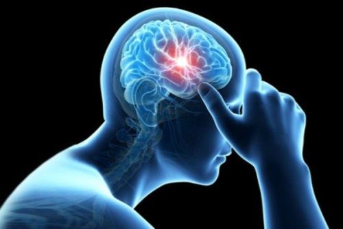 نرخ جهانی موارد سکته مغزی همچنان بالا است