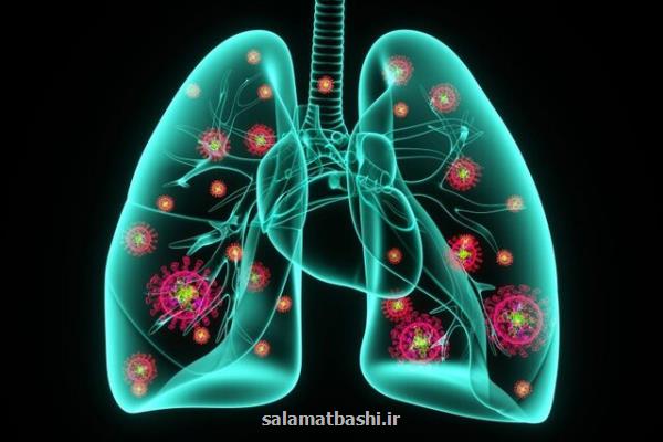 احتمال تاثیر کرونا در بروز ذات الریه