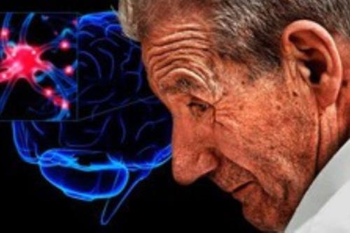 علایم اولیه بیماری پارکینسون را بشناسید