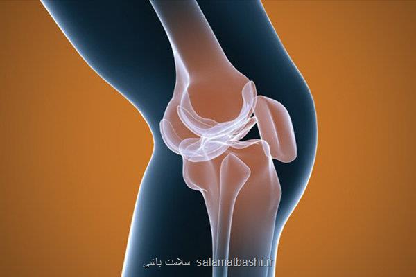 پرتودرمانی به تسکین درد آرتروز زانو کمک می نماید