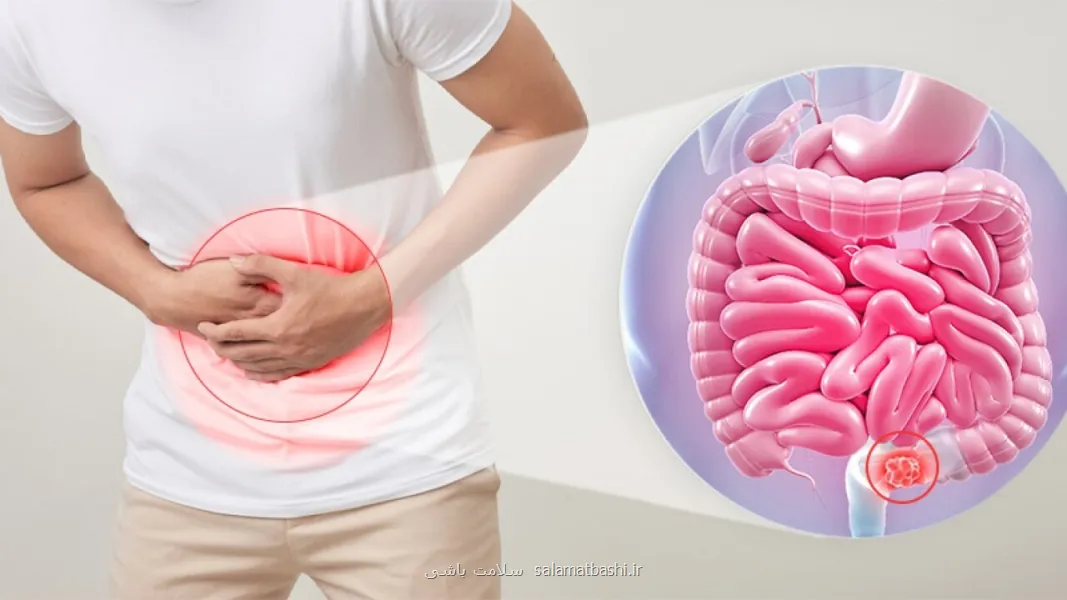 چرا وقتی استرس داریم، دستگاه گوارش ما دیوانه می شود؟