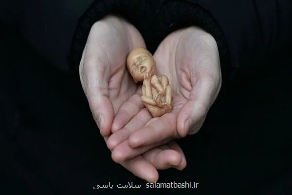 ۱۵ درصد حاملگی ها بصورت خود به خودی سقط می شوند