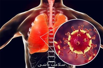 چگونگی مراقبت از بیماران خفیف كووید ۱۹ در منزل ابلاغ گردید