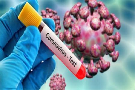 ناگفته های مردی كه 7000 تست كرونا انجام داده است